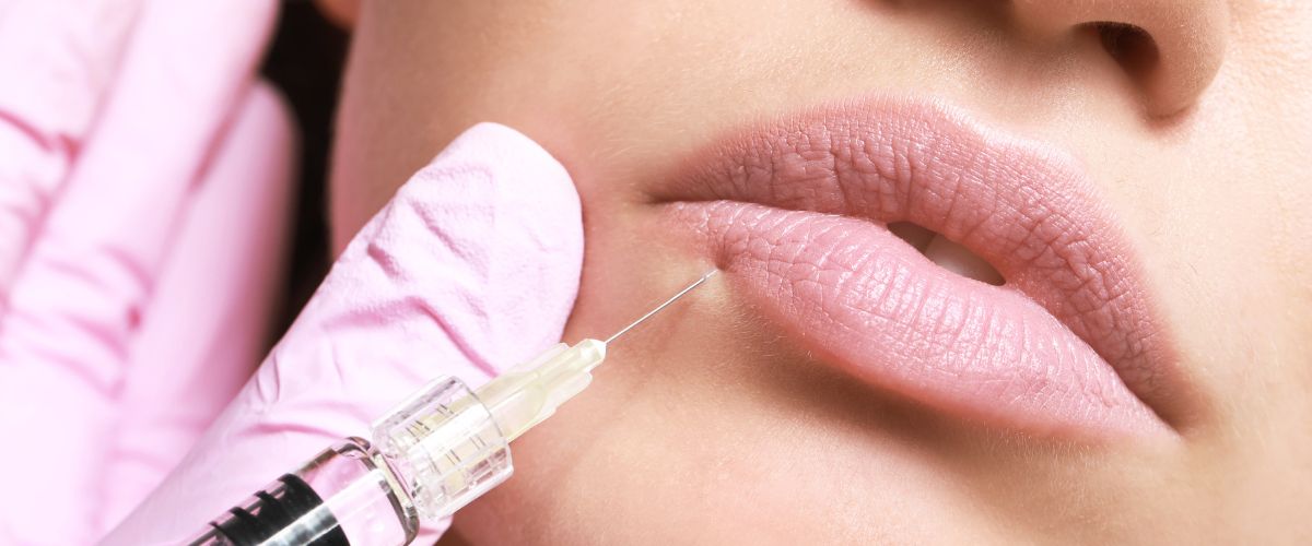 Fillers υαλουρονικού