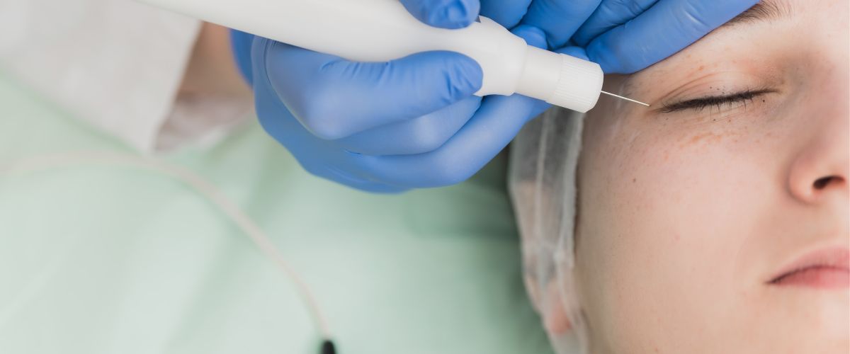 Θεραπείες βλεφάρων