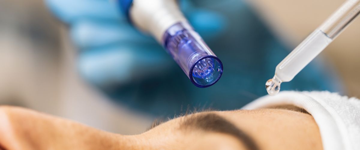 Μεσοθεραπεία Προσώπου