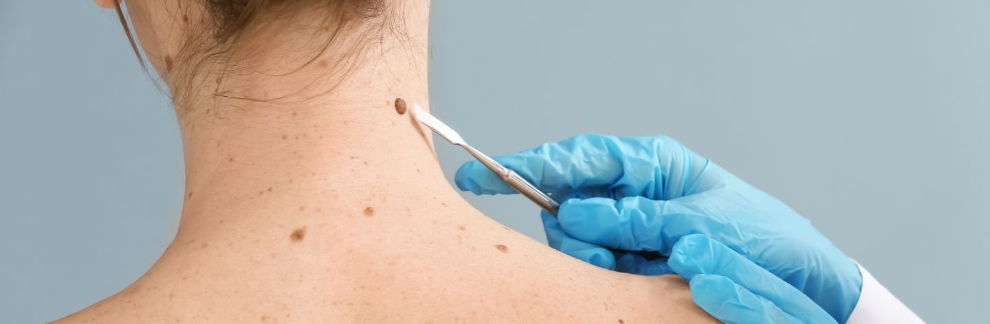 χειρουργική δέρματος